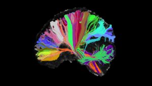 high-angular-resolution-diffusion-image-brain-2048x1152