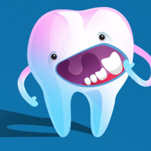Wisdom_Teeth_HEADER